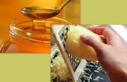 остеохондроза домашно лечение народни средства за защита (лечение) Лечение на остеохондроза в дома лекарствата от народната медицина