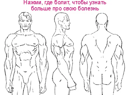 Лечение и симптоми на остеоартрит на раменната става, всичко за болки в кръста