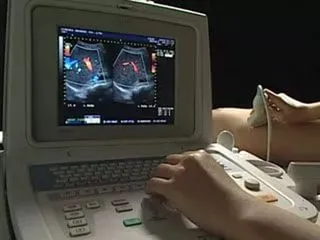 MRI в множествена склероза