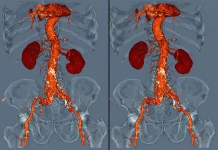 MRI с разлика - какво е това, указания и ограничения за извършване на