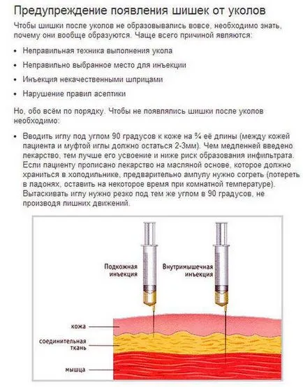 Фолк средства за конуси след инжекции