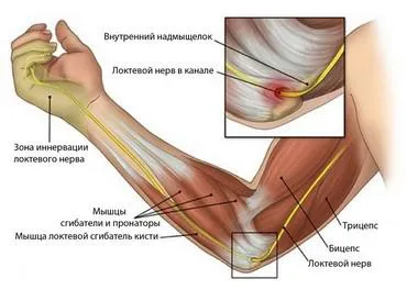 Тя вцепенява малкия пръст на дясната си ръка води до тактиката на
