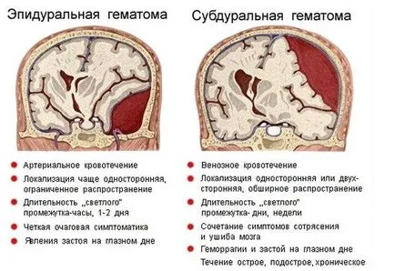 мозъка neurosonography новородени (grudnichka) какво е, до каква възраст