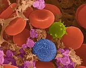 Пречистване на кръв, методи за пречистване на кръвта, плазмафереза, autohemotherapy, hemosorbtion