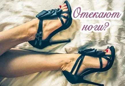 Защо отичане на краката при жените какво да прави с прииждането на крака