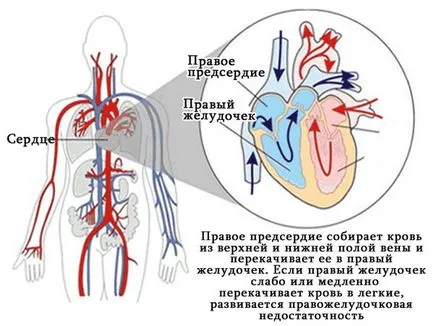 Деснокамерна сърдечна недостатъчност - причини, симптоми, признаци, лечение, оказване на първа помощ