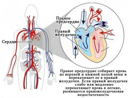 Право сърдечна недостатъчност, сърдечно-съдови заболявания