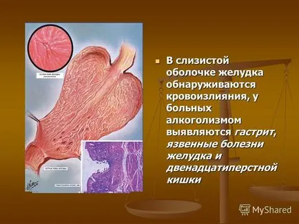 Представяне на Кажи навици - не