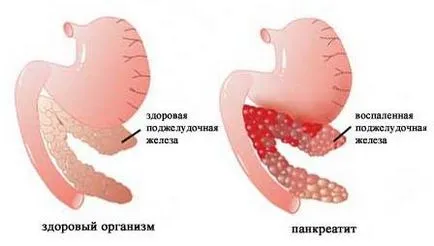 Пулсация в стомаха видове, Nature, причините и лечението