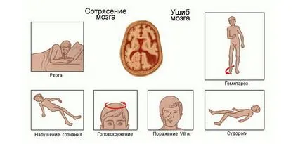 Детето си е ударил главата какво да търсят, какво да правя, последиците от удари главата си при деца (правя) Детето си е ударил главата какво да търсят, какво да правя, последиците от удари главата си при деца