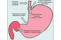 Повръщане след като е пил какво да правя