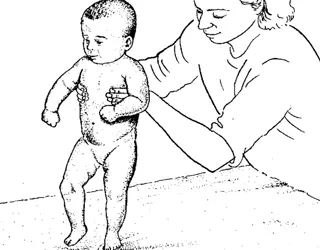 двигателни нарушения синдром причини, лечения, снимка, RU-babyhealth