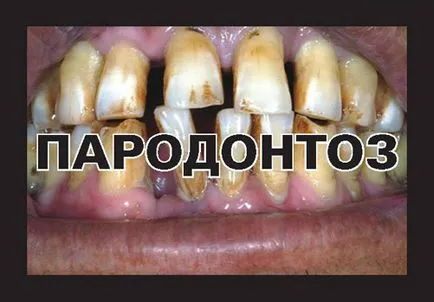 Ужасни снимки 