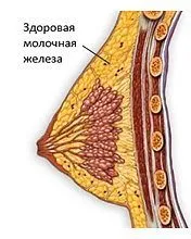 Diffúz cisztás mastopathia