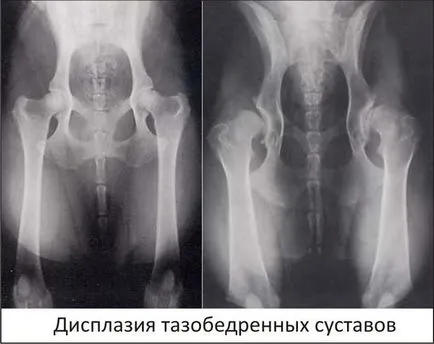 Hip diszplázia gyerekek, hogyan kell kezelni (csípő kezelt gyermekeknél kengyelben párna Frejka) Hip diszplázia gyerekek, hogyan kell kezelni
