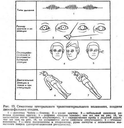 Differenciáldiagnosztikája kómás állapotok