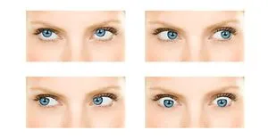 Тъмна кожа около очите - Причини и превенция