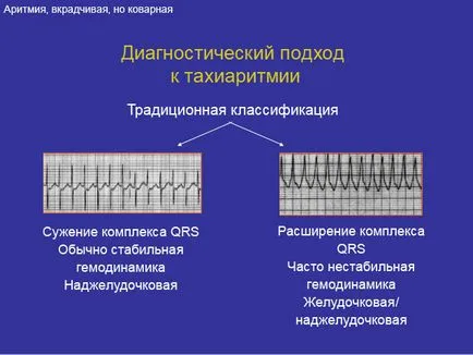 Тахиаритмии какво е, причини, симптоми и лечение