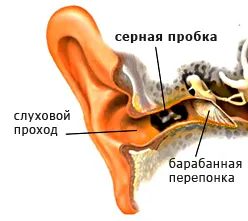Ухото щепсел причини, симптоми, лечение