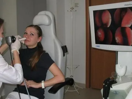 Vasotomy конхи какво е, причинява операция в долната част на носа и нейните видове