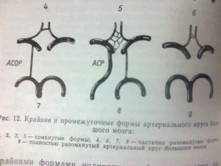 Willis развитие кръг верига, лечение, симптоми, лекар дебелина (кръгче) Willis развитие кръг верига, лечение, симптоми, лекар дебелина