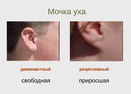 Врастнали или прилежащите към ушите - причини, диагноза и лечение