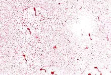 Vibrio холерният - това