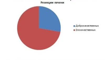 Оперативно лечение на тумори на черния дроб в fbuz 