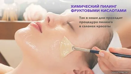 Химически пилинг - пилинг плодови киселини