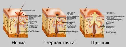 Мазната кожа на лицето какво да правя у дома, каузи