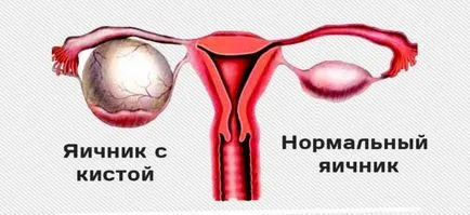 Болки в дясната страна в долната част на корема на жена