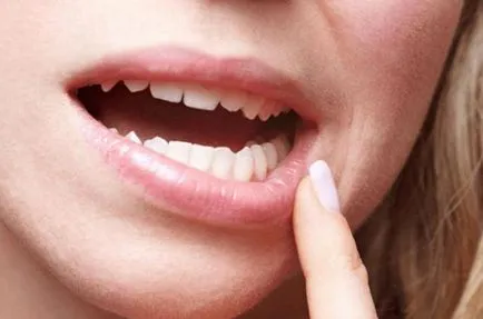 Rajtbírók értékeléseket Kappa az összehangolás a fogak (aligners vélemény szakemberek) Rajtbírók értékeléseket kappa a fogak igazítás