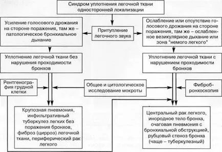 Диагностика, диференциална диагноза и лечение на синдрома на белодробен паренхим уплътнение (синдром) Диагностика, диференциална диагноза и лечение на синдрома на белодробен паренхим компресия