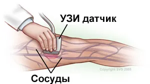 ултразвуков доплер