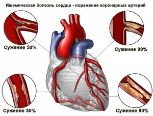 Ход и неговите последици