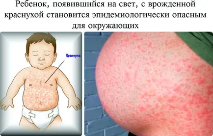 Szakaszában készül nők IVF és az esetleges komplikációk