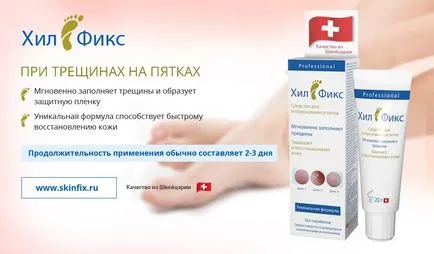 Как да се лекува напуканите пети