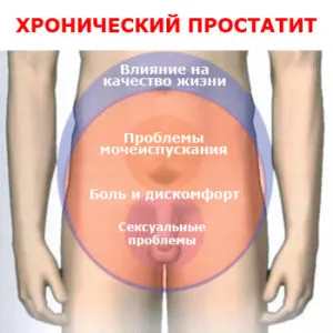 Когато да направи инжекции от простатит кои лекарства за употреба (лекарства) Когато да направи инжекции от простатит кои лекарства за използване