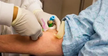 Hepatitis B és mi ez, és hogyan kerül továbbításra, a tünetek egy fertőző betegség, a diagnózis és a kezelés Botkin