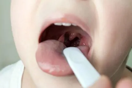 Lapok Geksoral használati utasítás, visszacsatolás (Geksoral Lapok Lapok Geksoral aeroszol Geksoral utasítás) Geksoral Lapok használati utasítás, vélemények