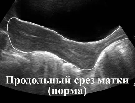 Nőgyógyászati ​​ultrahang 1