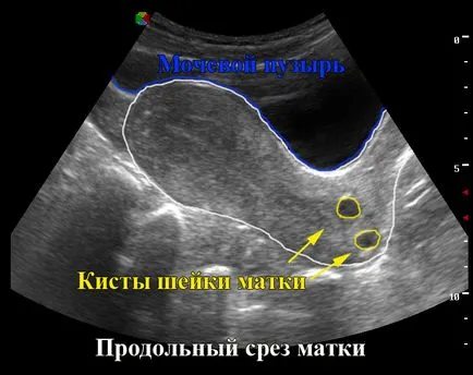 Nőgyógyászati ​​ultrahang 1