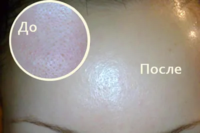 Лицеви маски от безцветна къна - рецепти, полезни свойства къна за кожата
