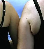 Hormonok és a túlsúly, hormonok hatása túlsúlyos nő (befolyás) Hormonok és a túlsúly, a hormonok hatása túlsúlyos nők