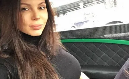 Оксана Samoilova преди и след пластмаса - 300