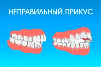 Защо едно дете хърка по време на сън през нощта, и дюзата не е - как да се отнасяме
