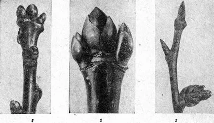 Бъбреците 1949 гр eytingen
