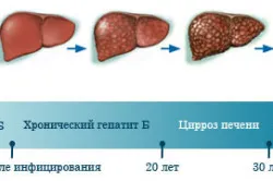 Ваксинирането срещу дифтерия
