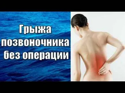 gerinc sérv - hogyan lehet megbirkózni a betegséggel egyszerű népi jogorvoslati (gerinc) gerinc sérv - hogyan lehet megbirkózni a betegséggel egyszerű népi jogorvoslati