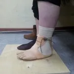 Простетичната подножието